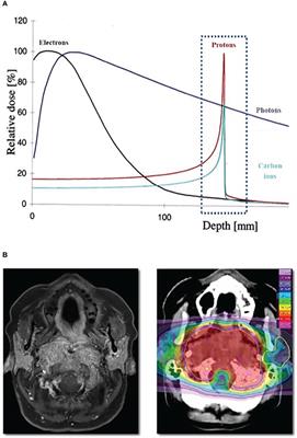 The role of particle radiotherapy in the treatment of skull base tumors